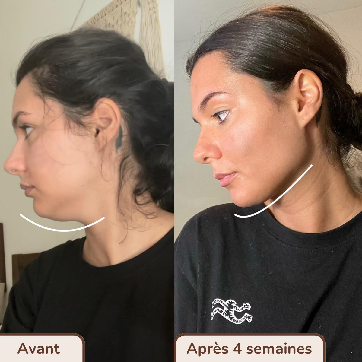 Brosse drainante visage anti-gonflements